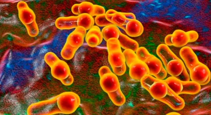 El botulismo es una enfermedad causada por neurotoxinas