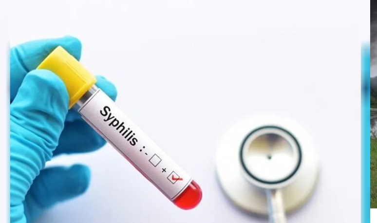 SÍFILIS